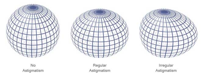 What Do Lights Look Like with Astigmatism? Tips for Night Driving 10 astigmatism sphere