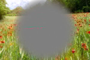 A Closer Look at Scotoma (Blind Spot in Vision)