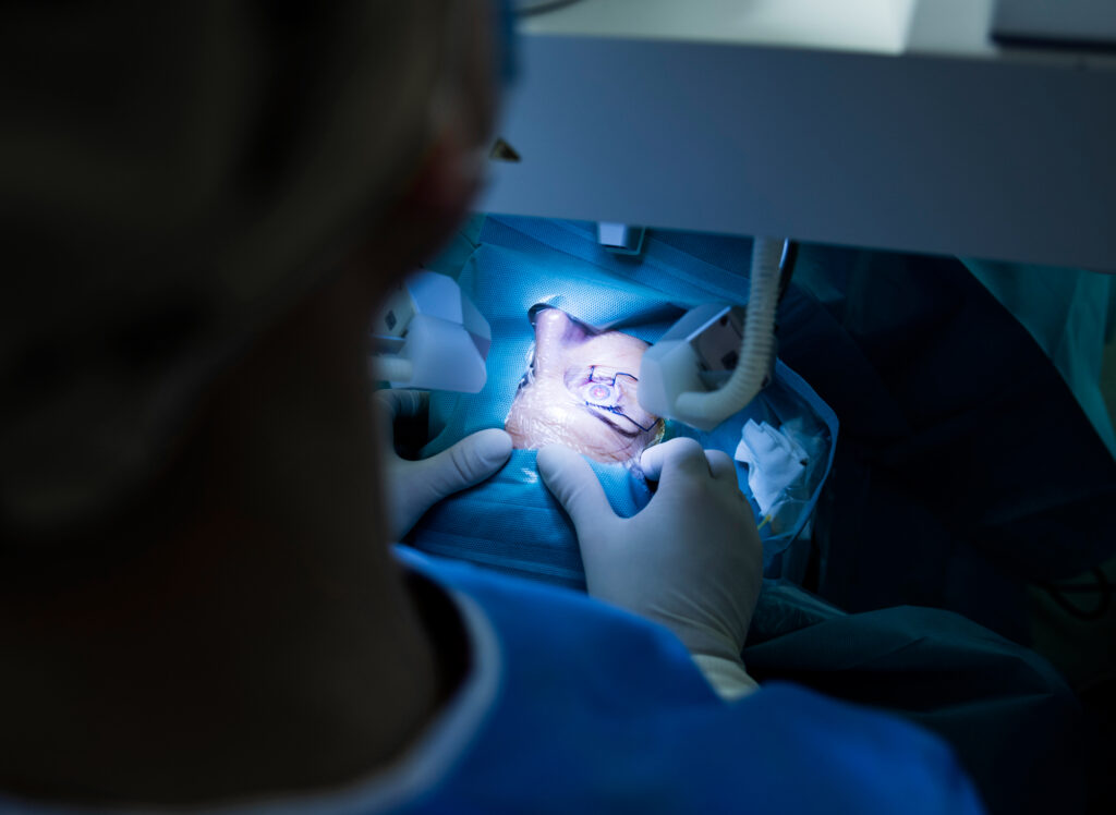 How Long Does LASIK Surgery Take? 3 Close up shot of a patient undergoing a cataract operation