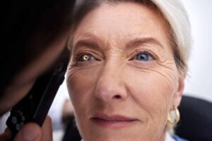 What is Diamox Used for in Glaucoma Care?