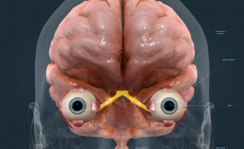 How Crucial Is the Chiasm Optic for Vision? 3 Optic Chiasm image