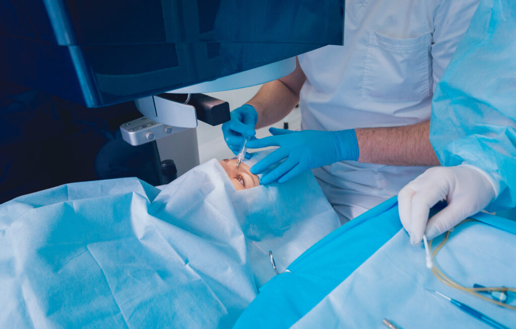 What to Expect After Keratoconus Surgery 4 Patient and team of surgeons in operating room during ophthalmic surgery