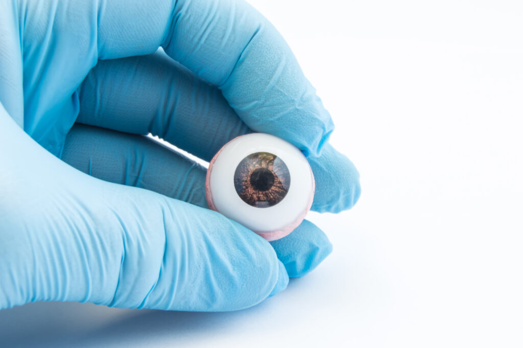Prosthetic Eye: Surgery, Costs and Care 2 Prosthetic eye held by a surgeon wearing medical gloves