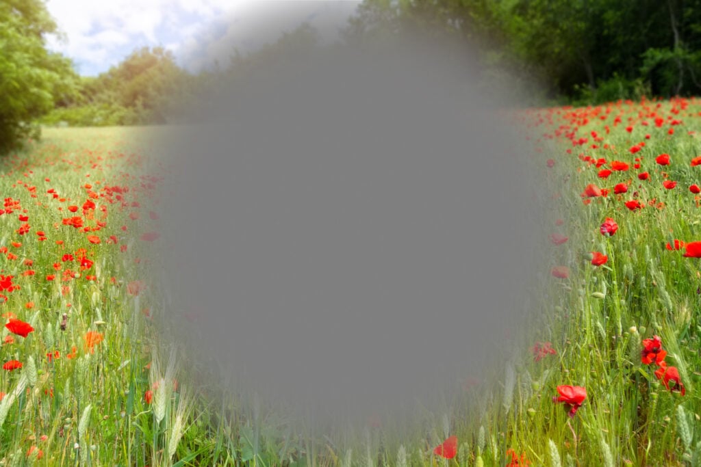What is Age-Related Macular Degeneration? Causes, Prevention, & Treatment 6 Symptom of AMD
