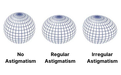 What Is Astigmatism? 4 Astigmarism sphere edited