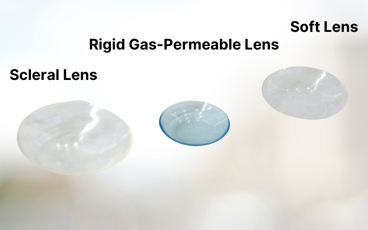 Types of Contact Lenses 6 scleral vs rgp vs soft contact lenses VC edited